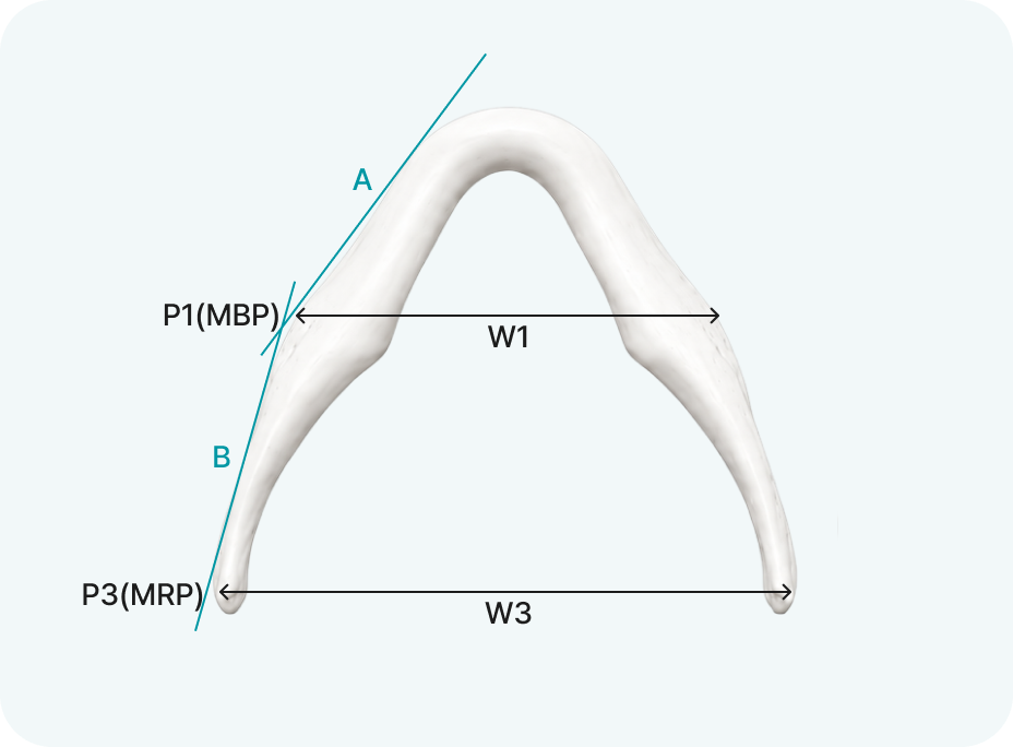 MBP/MRP diagram 30
