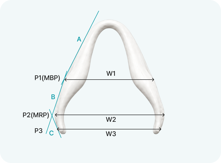 MBP/MRP diagram 31