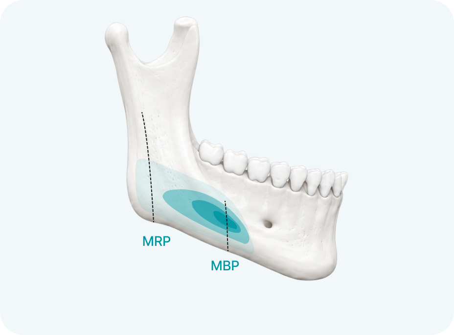 MBP/MRP diagram 32