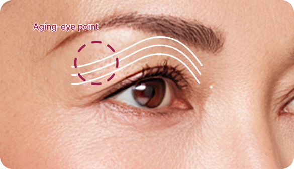 id Hospital - Browlift - Before Surgery
