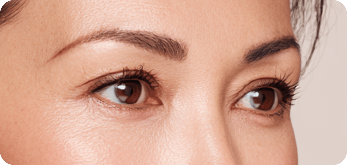 id Hospital - Lower Blepharoplasty - Delicate Suturing