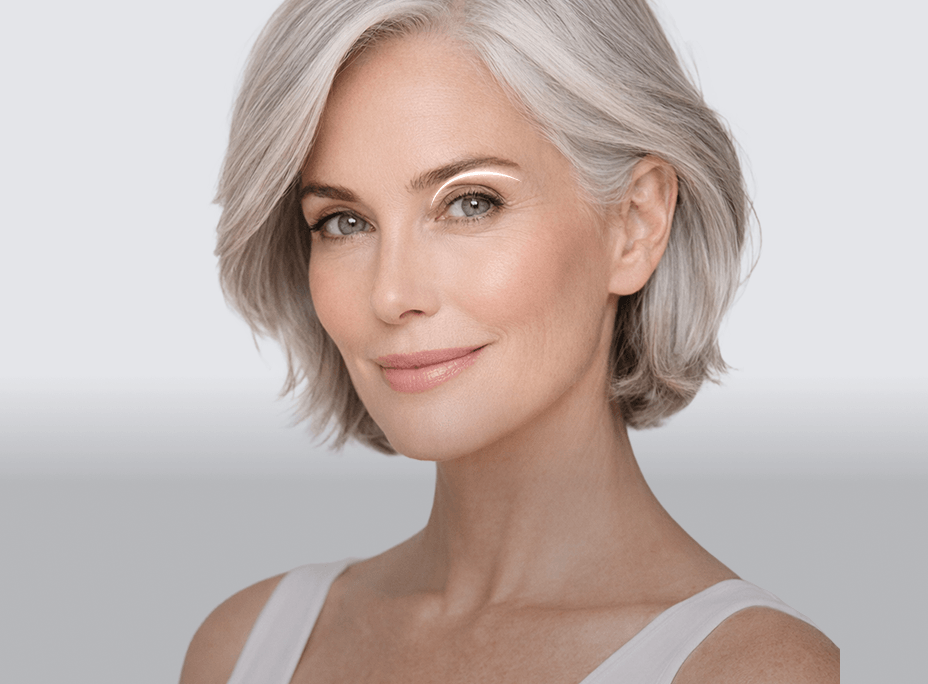 Upper Blepharoplasty
