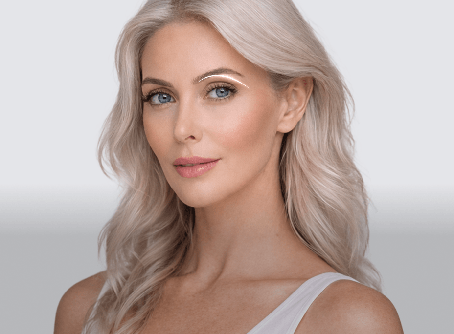 Middle-Age Ptosis Correction