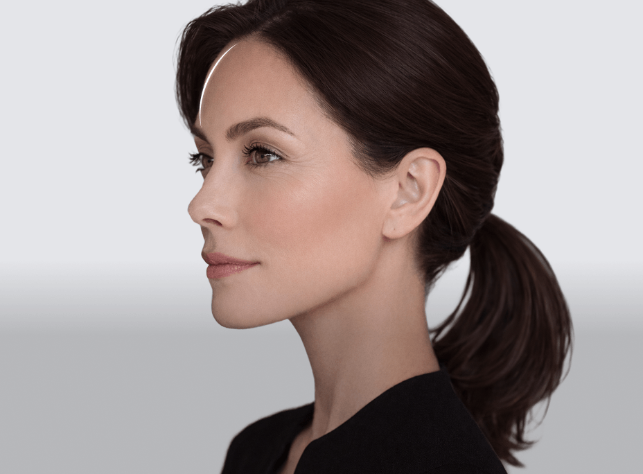 Endotine Forehead Lift