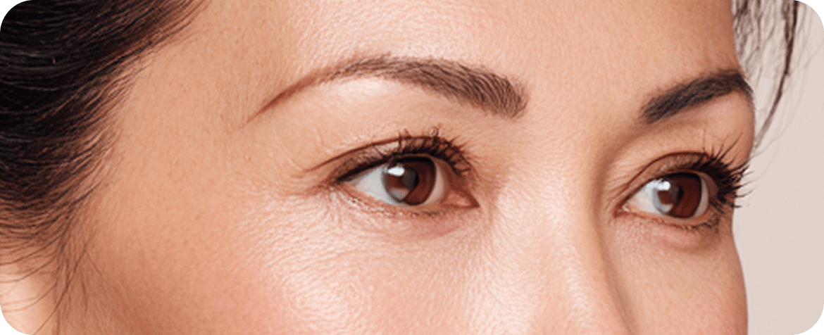 id Hospital - Upper Blepharoplasty - Delicate Suturing