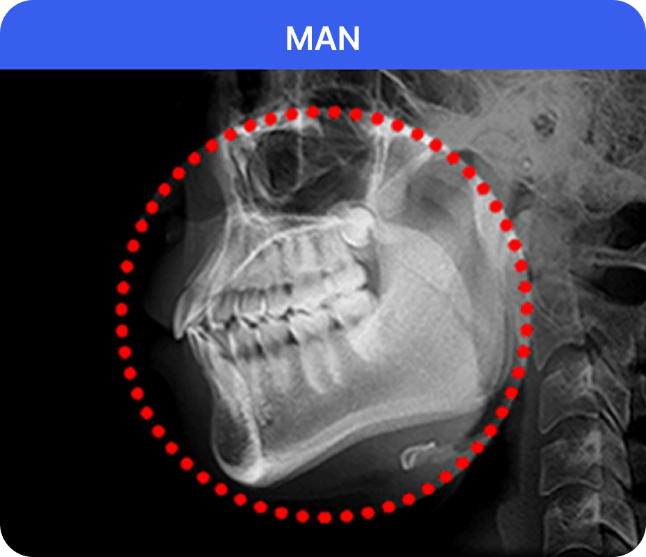 id Hospital - Male Facial Contouring - WOMAN Bone Structure X-Ray