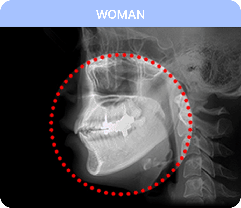id Hospital - Male Facial Contouring - MAN Bone Structure X-Ray