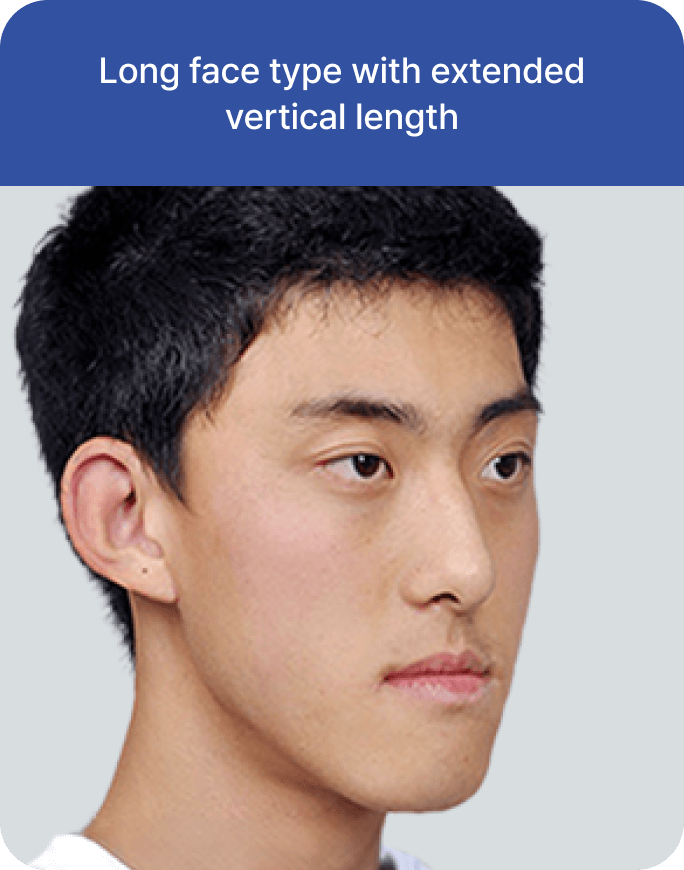 id Hospital - Male Orthognathic Surgery - Candidate Type 2