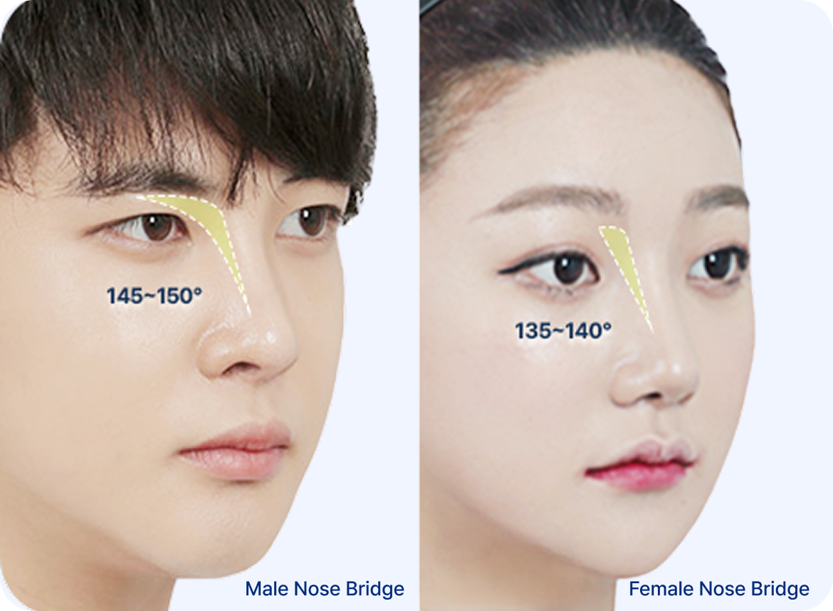 id Hospital - Male Rhinoplasty - The Starting Angle Makes All the Difference
