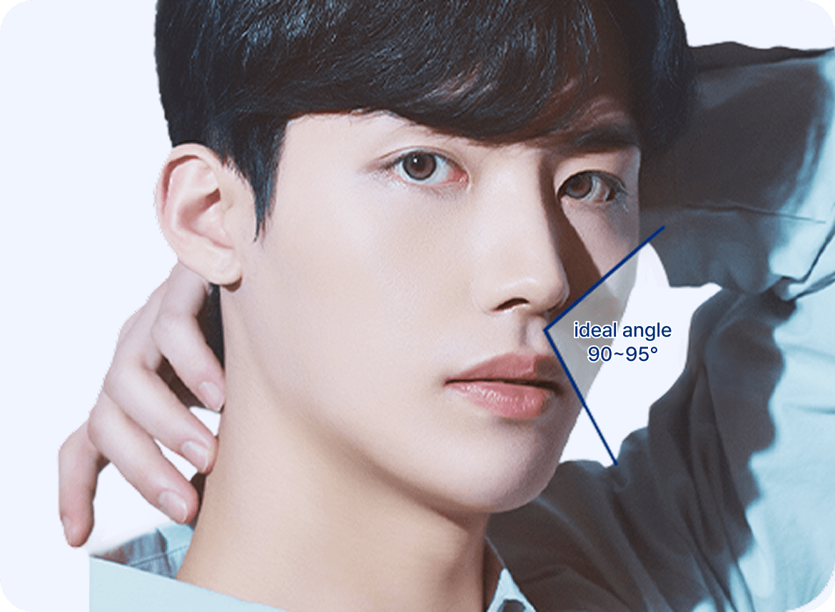 id Hospital - Male Rhinoplasty - The Nasolabial Angle 90 Degrees
