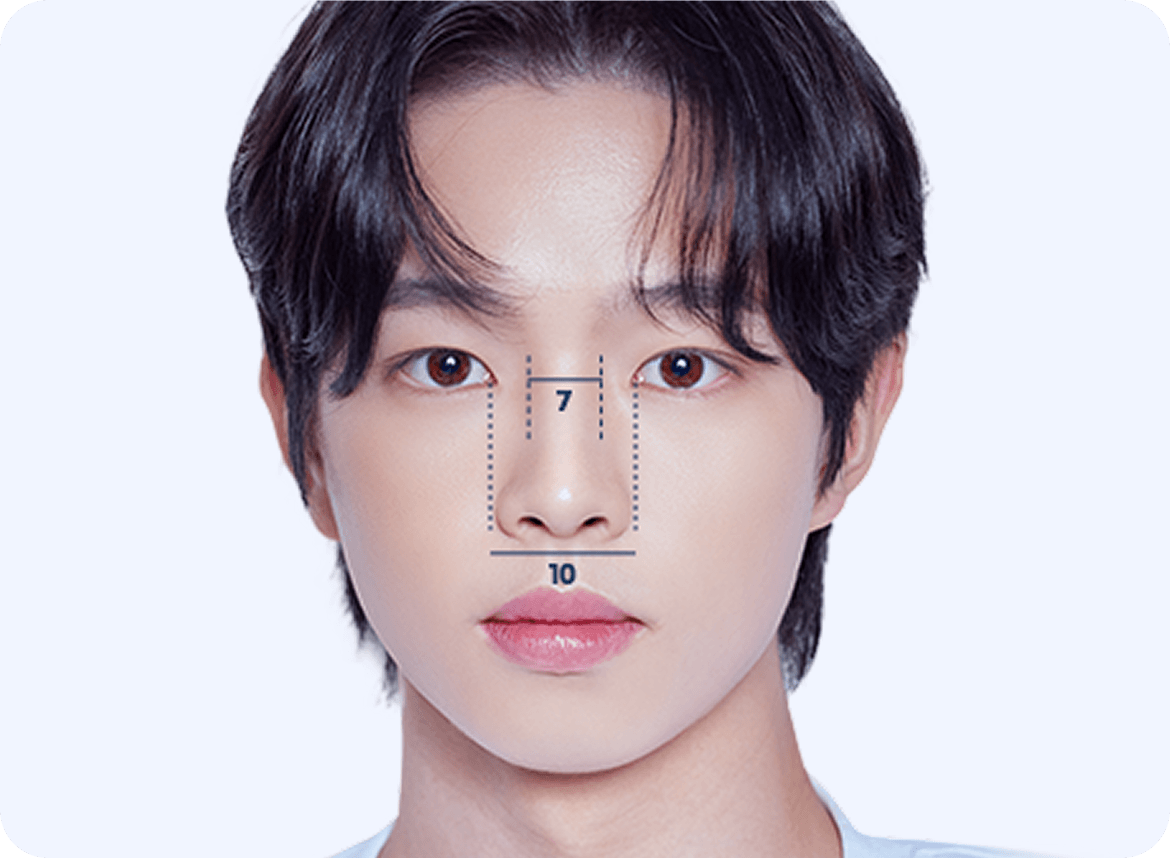 id Hospital - Male Rhinoplasty - Voluminous Nasal Tip Ratio 10 to 7