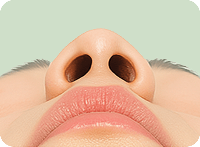 id Hospital - Alar Reduction - Low Nose Analysis