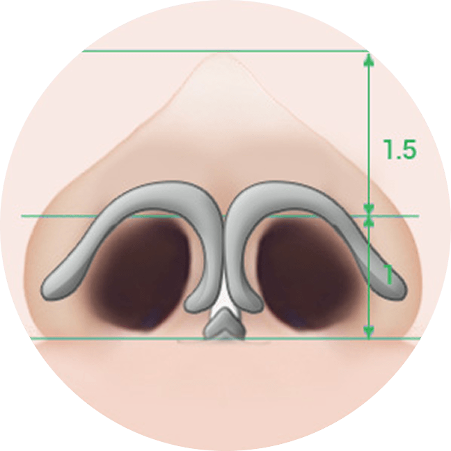 id Hospital - Asian Rhinoplasty - Generic Rhinoplasty Nose Tip