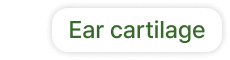 id Hospital - No-Implant Nose - Ear Cartilage Label