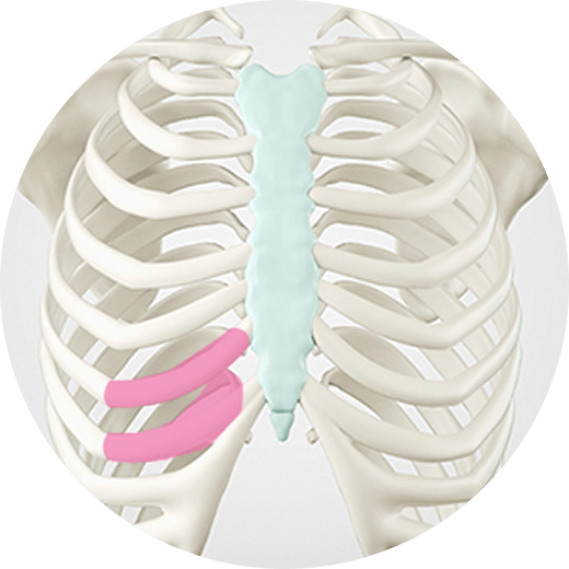 id Hospital - No-Implant Nose - Rib Cartilage