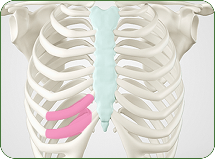 id Hospital - No-Implant Nose - Harvesting Autologous Rib Cartilage