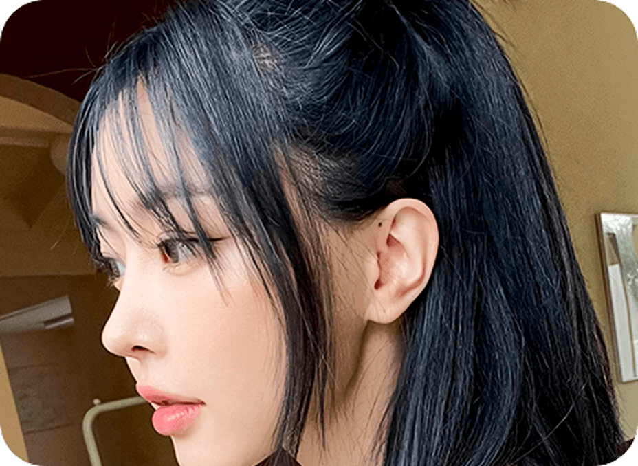 id Hospital - Rhinoplasty - Glamorous Nose Tip