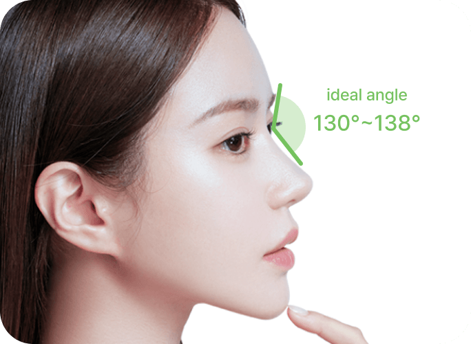 id Hospital - Rhinoplasty - Creating a Natural Nose Line