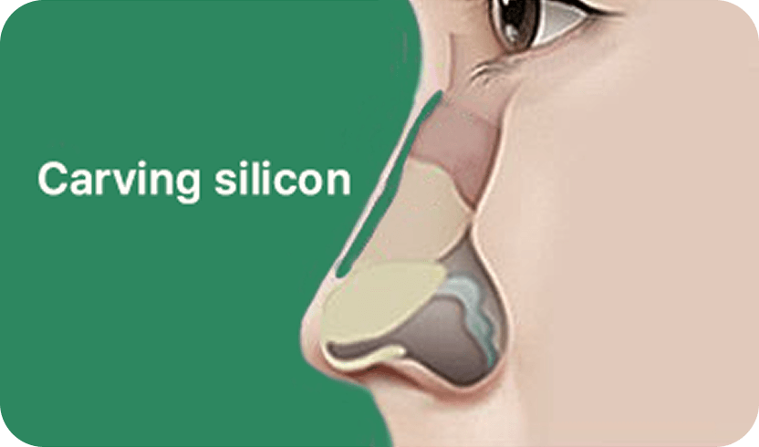 id Hospital - Rhinoplasty - Carving Silicone Nose Surgery