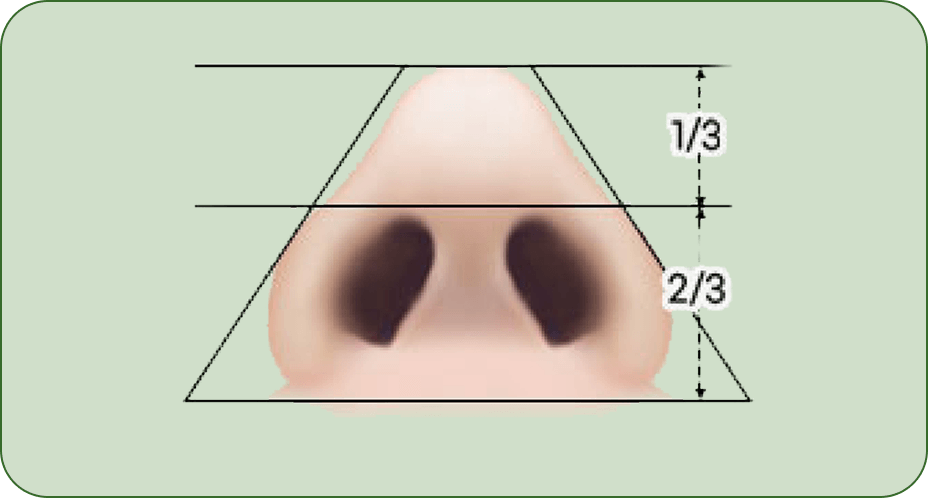 id Hospital - Rhinoplasty - Barbie Line Step 2