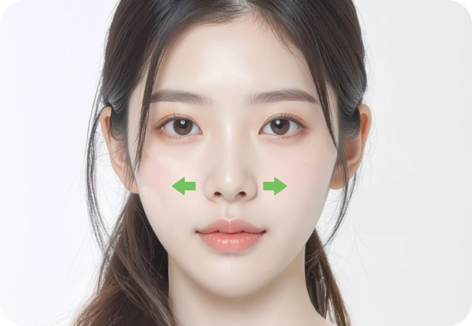 id Hospital - Nose Revision - When the implant shifts