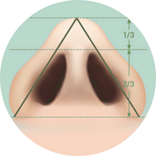 id Hospital - Nose Revision - Rib Cartilage Revision Step 3