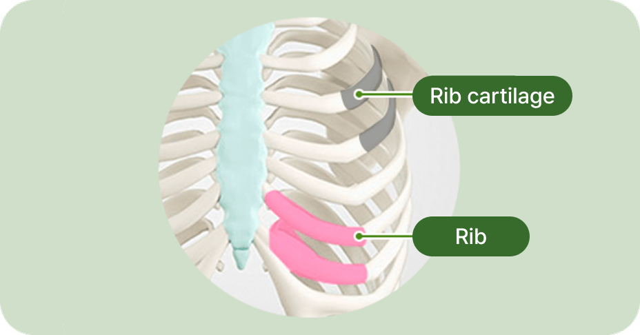 id Hospital - Nose Revision - 3-Point Warping Prevention Process