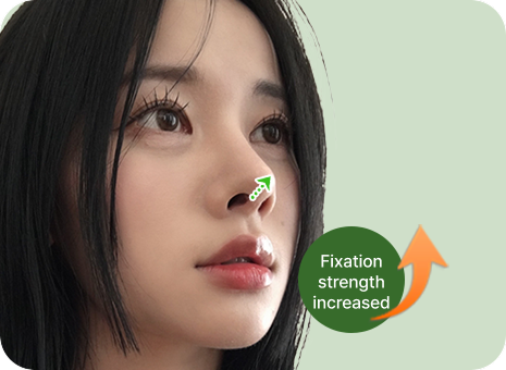id Hospital - Nose Revision - Glamorous Nose Nasal Tip Support