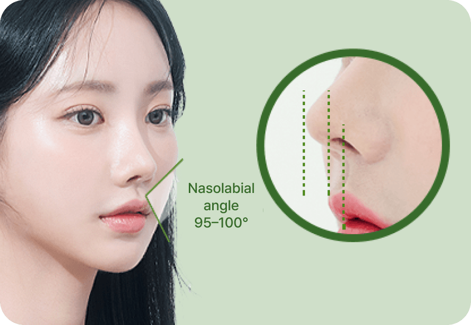 id Hospital - Nose Revision - Elevated Tip Importance