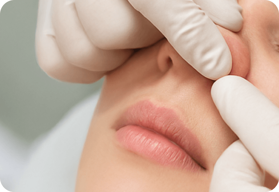 id Hospital - Nose Revision - Pressure