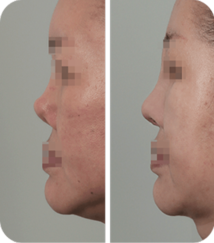 Before & After image