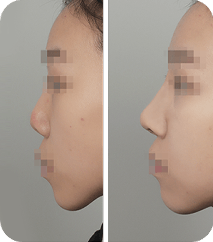 Before & After image