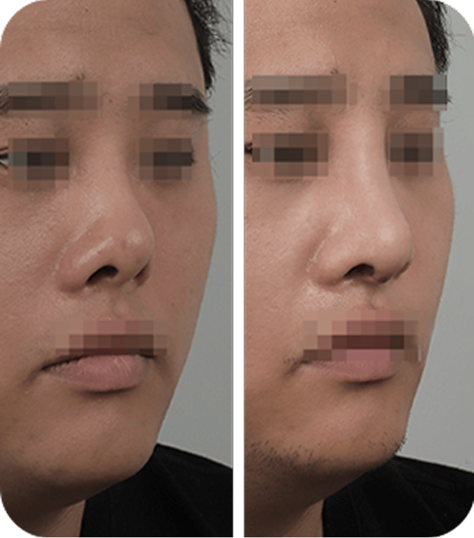 Before & After image