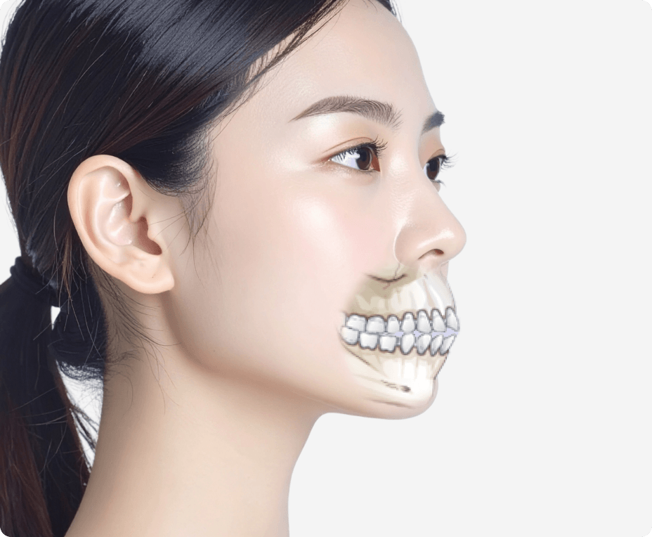 id Hospital - Mouth Protrusion Surgery - Protruding Mouth Correction