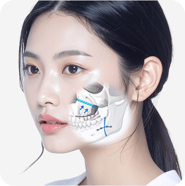 id Hospital - No-tie Orthognathic Surgery - Maxillary Resection and Repositioning