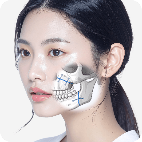 id Hospital - No-tie Orthognathic Surgery - Normal Position of TMJ