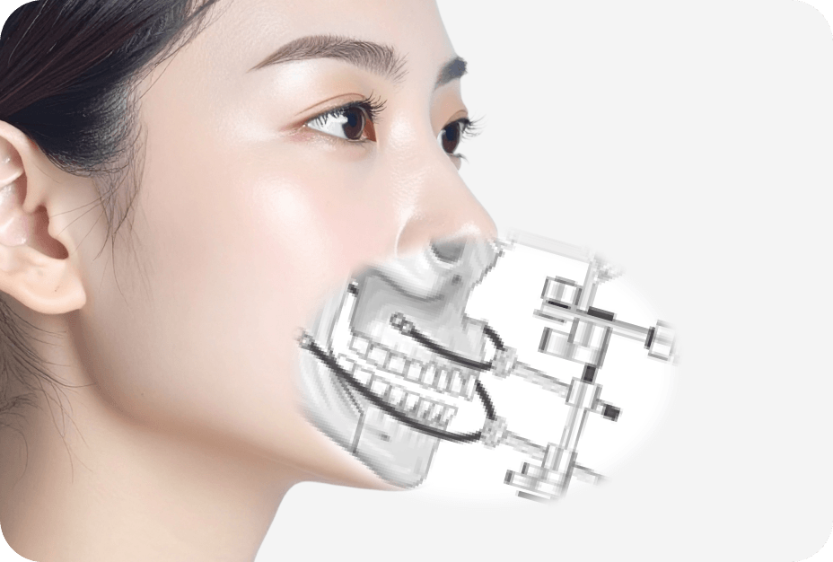 id Hospital - No-tie Orthognathic Surgery - Ultra-precise Jaw Joint Registration System