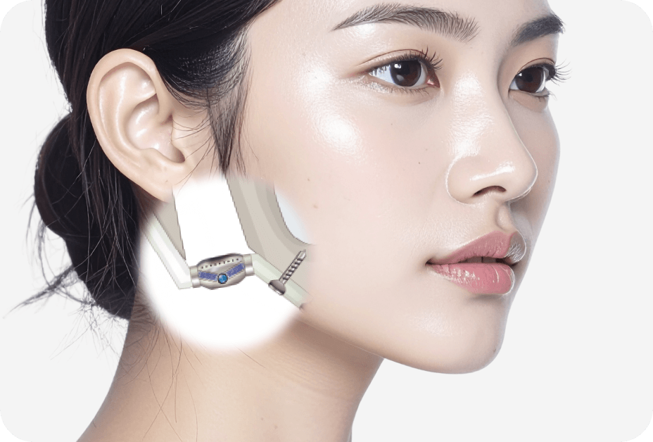 id Hospital - No-tie Orthognathic Surgery - Joint Surgery