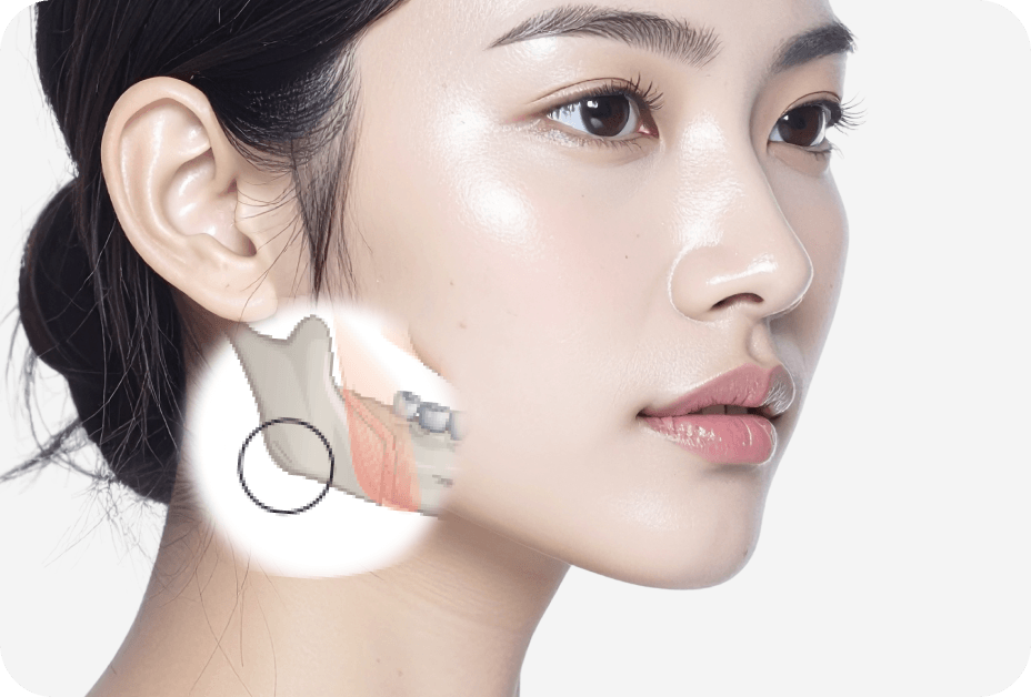 id Hospital - No-tie Orthognathic Surgery - Occlusion Surgery