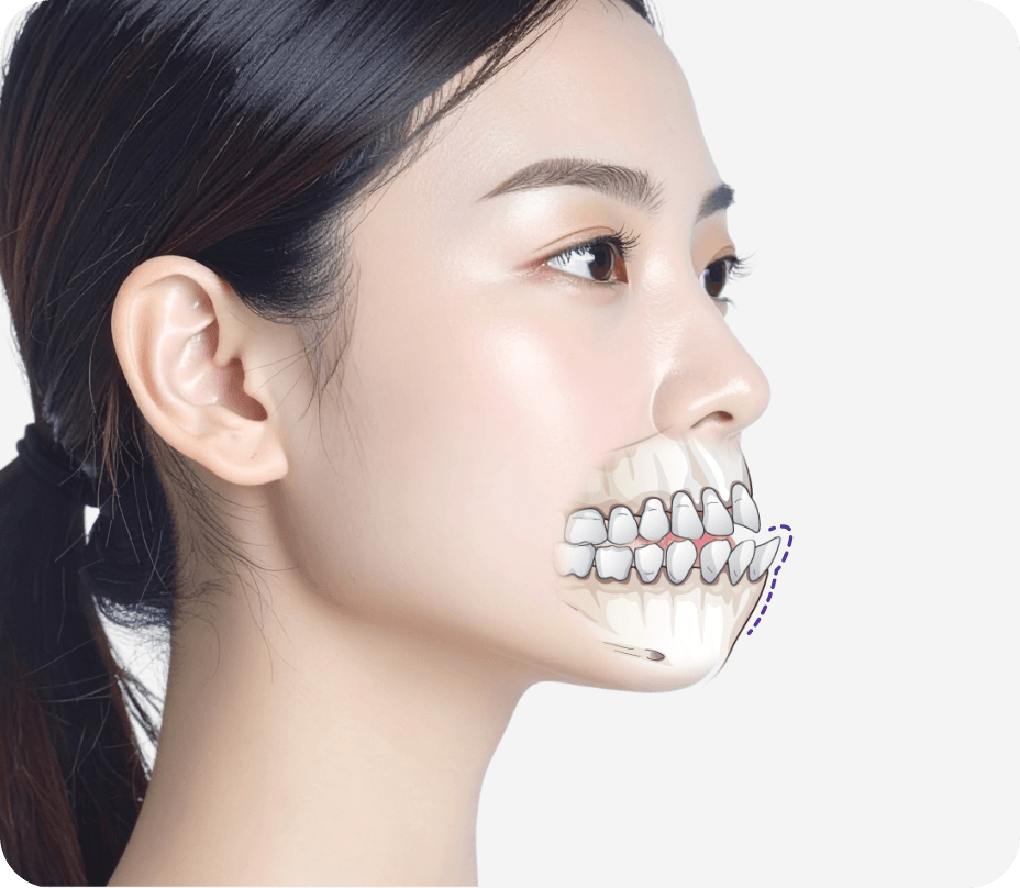 id Hospital - Three-Jaw Surgery - Two-Jaw Surgery