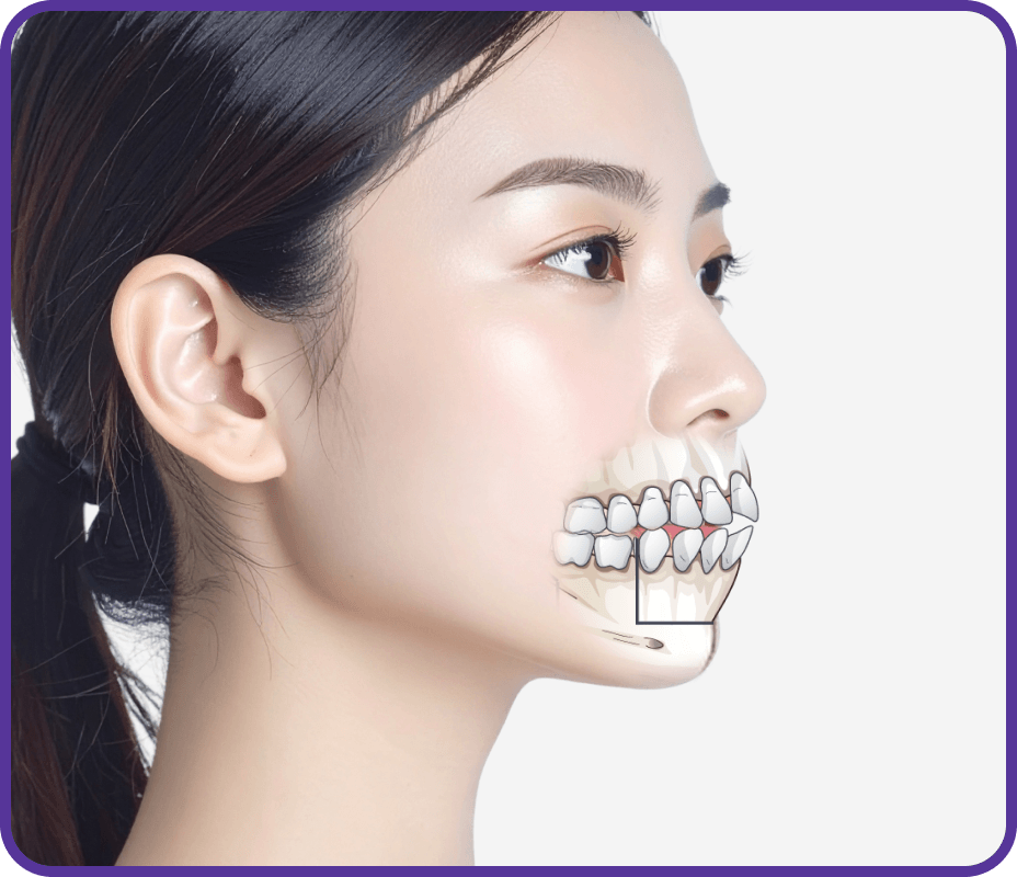 id Hospital - Three-Jaw Surgery - Three-Jaw Surgery