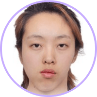 id Hospital - Surgery-First Approach Orthognathic Surgery - Traditional - Treatment period for surgery 1 month