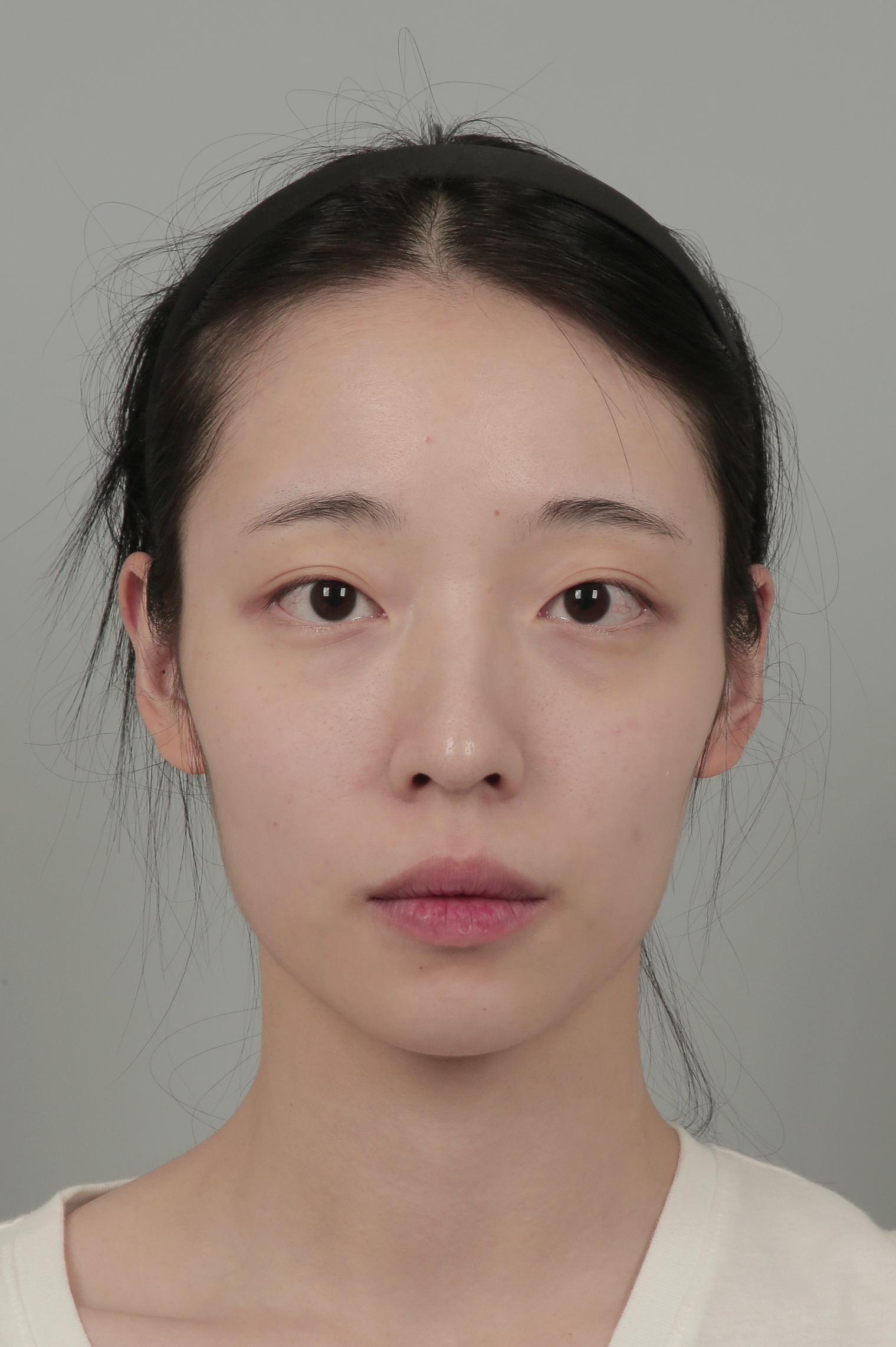 id Hospital - Patient Case Review - Before