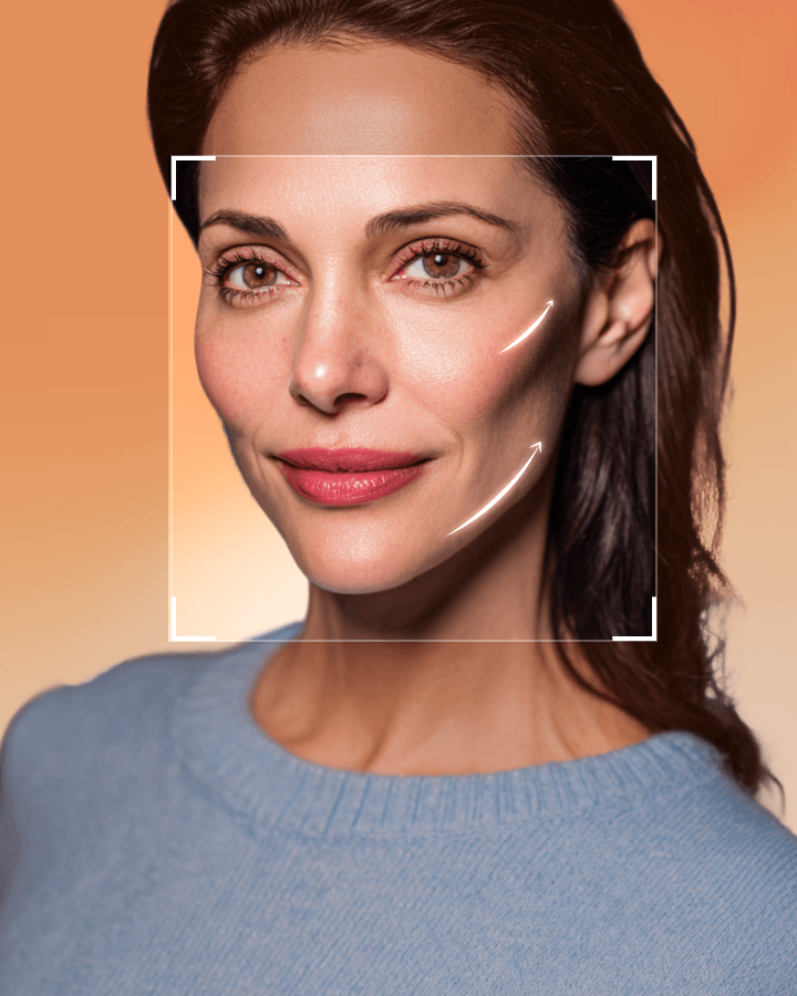 Mini Forehead & Mini Double Chin Lift