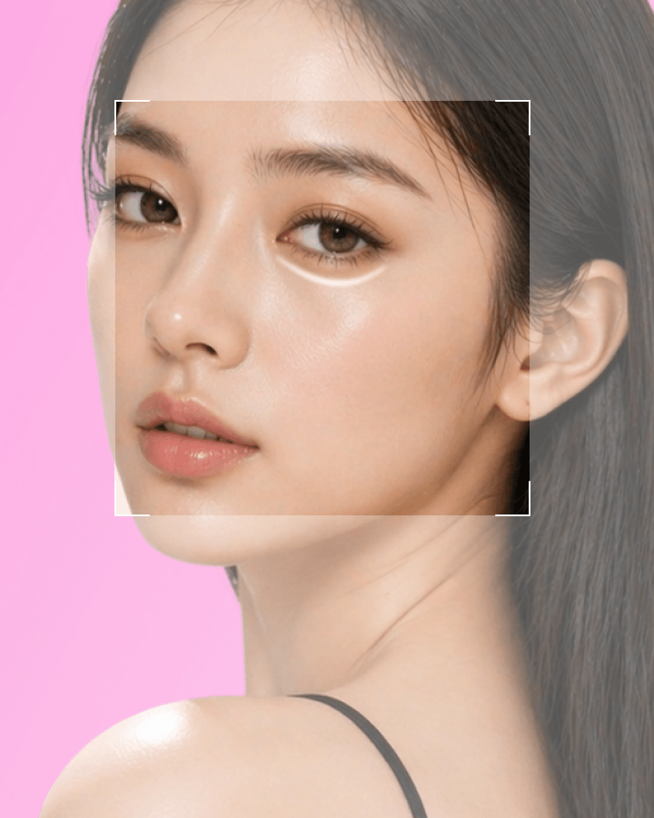 Under Eye Fat Repositioning