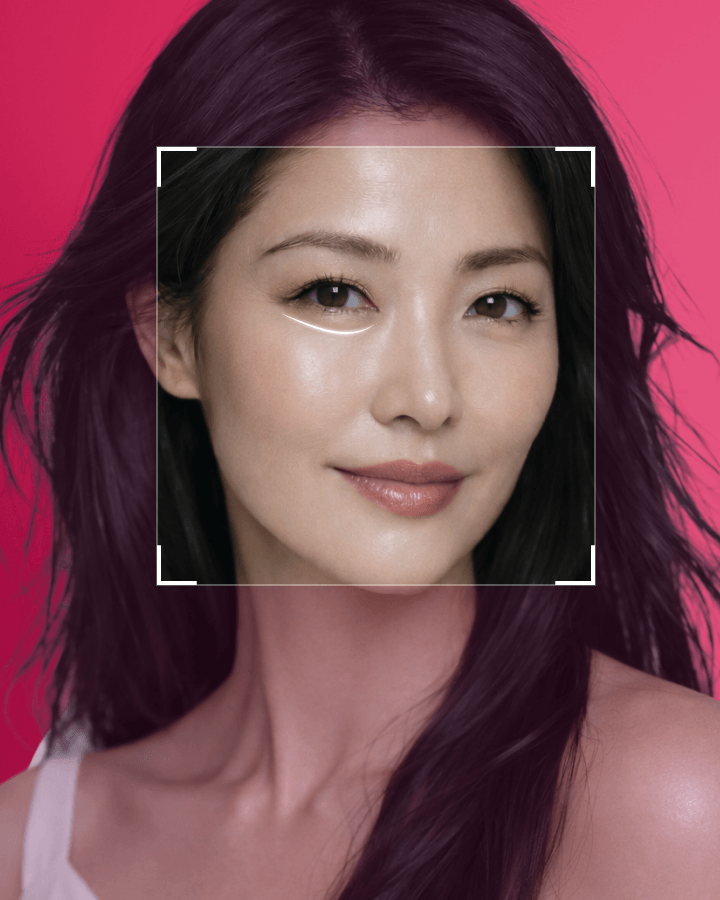 Middle-age Under Eye Fat Re-positioning