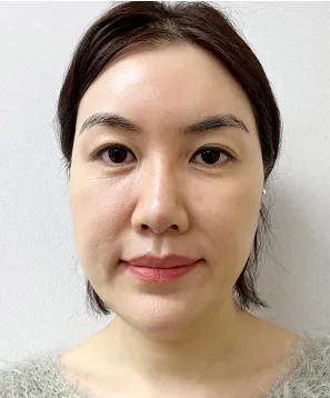 id Hospital - Real Selfies - Jihye Choi - 1