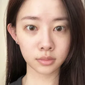 id Hospital - id Real Selfie - Yoojung Choi Before