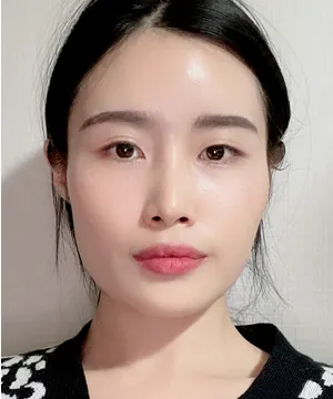 id Hospital - id Real Selfie - Jiyeon Lee Before