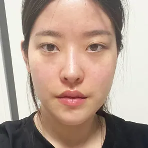 id Hospital - Real Selfies - Kyunghee Lee - 2